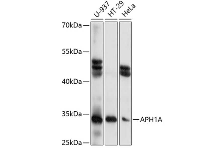 Western Blot - Anti-APH1A Antibody (A89261) - Antibodies.com
