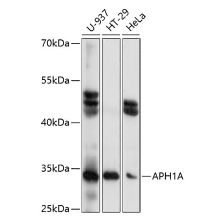 Western Blot - Anti-APH1A Antibody (A89261) - Antibodies.com