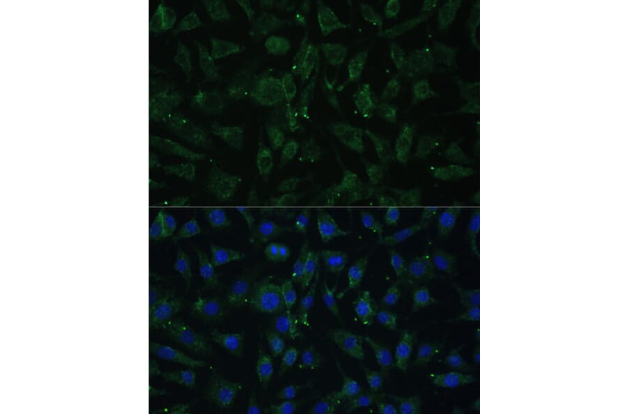 Immunofluorescence - Anti-APH1A Antibody (A89261) - Antibodies.com