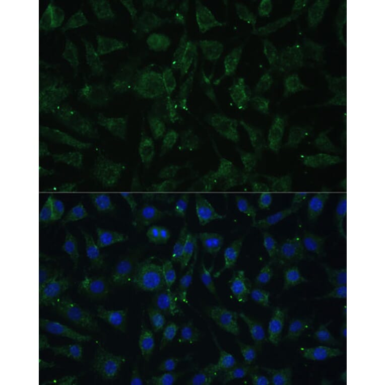 Immunofluorescence - Anti-APH1A Antibody (A89261) - Antibodies.com