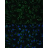 Immunofluorescence - Anti-APH1A Antibody (A89261) - Antibodies.com