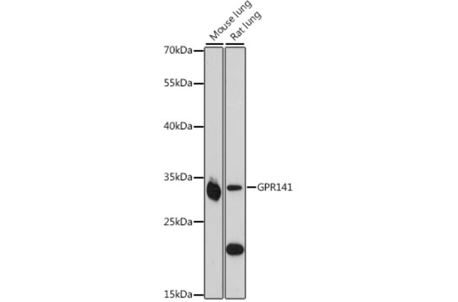 Western Blot - Anti-GPR141 Antibody (A89262) - Antibodies.com