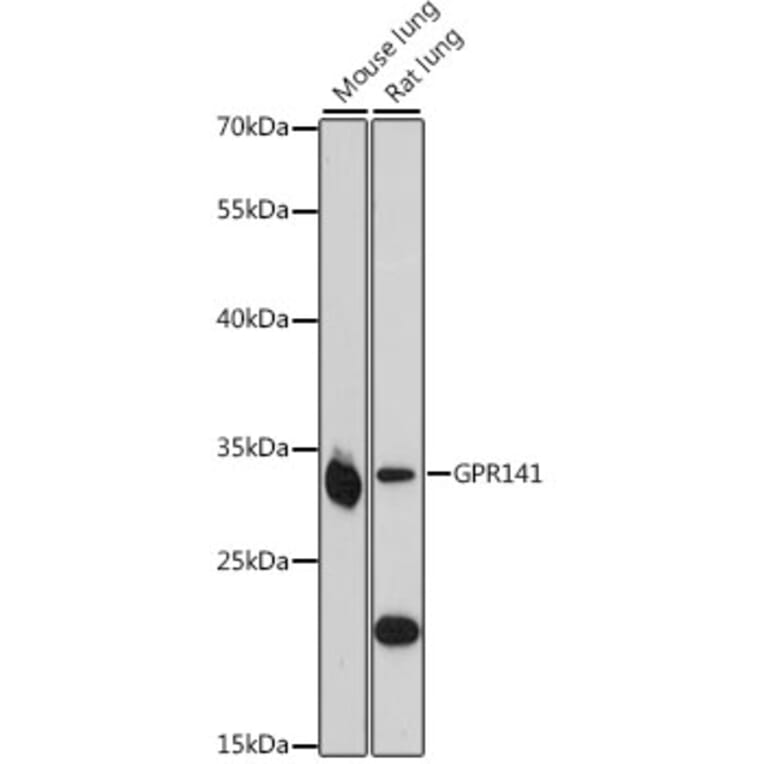 Western Blot - Anti-GPR141 Antibody (A89262) - Antibodies.com