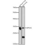 Western Blot - Anti-GPR141 Antibody (A89262) - Antibodies.com