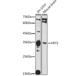 Western Blot - Anti-HEY1 Antibody (A89263) - Antibodies.com