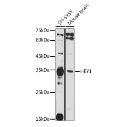 Western Blot - Anti-HEY1 Antibody (A89263) - Antibodies.com