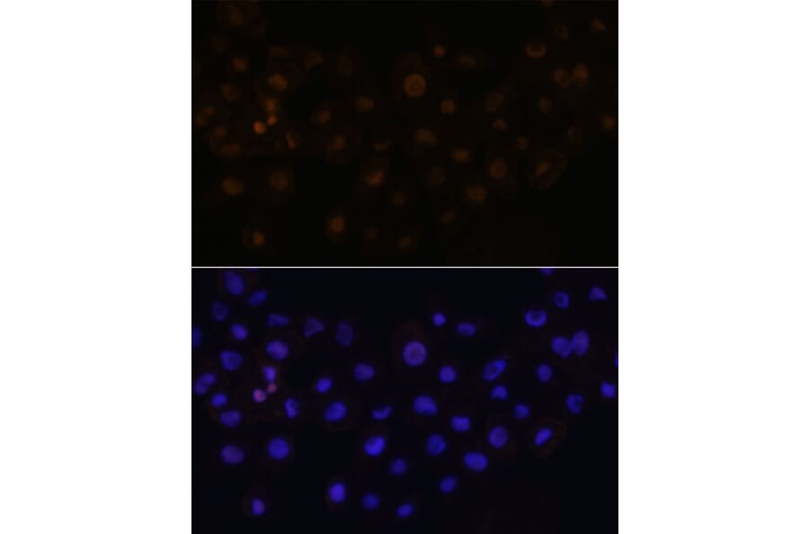 Immunofluorescence - Anti-HEY1 Antibody (A89263) - Antibodies.com