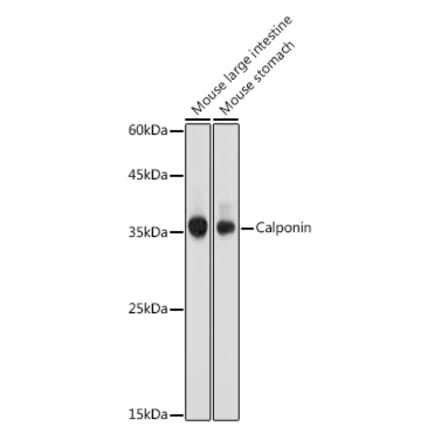 Western Blot - Anti-Calponin 1 Antibody (A89264) - Antibodies.com