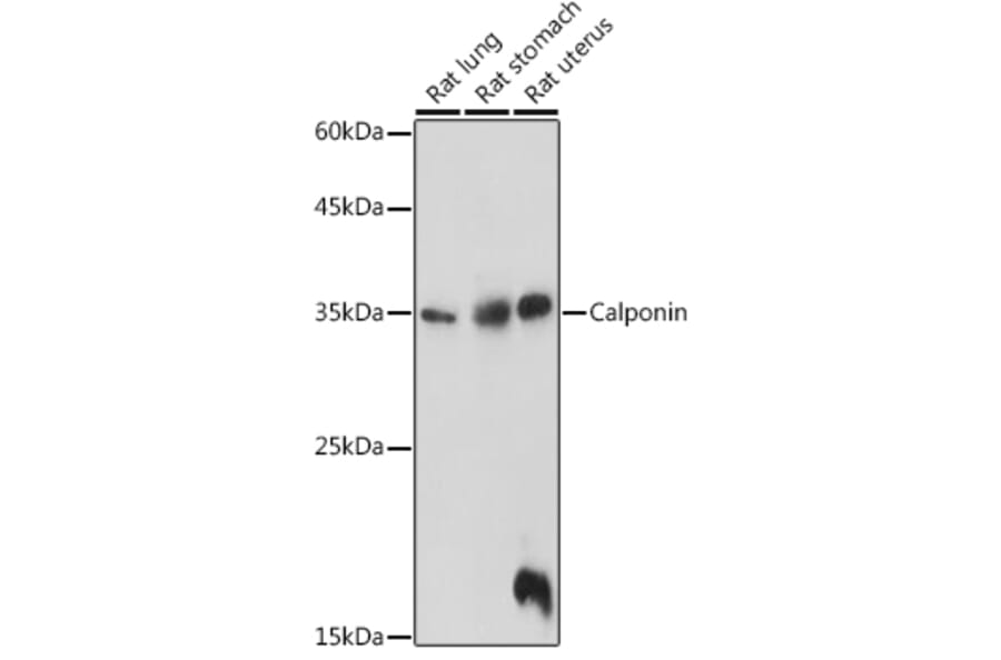 Western Blot - Anti-Calponin 1 Antibody (A89264) - Antibodies.com