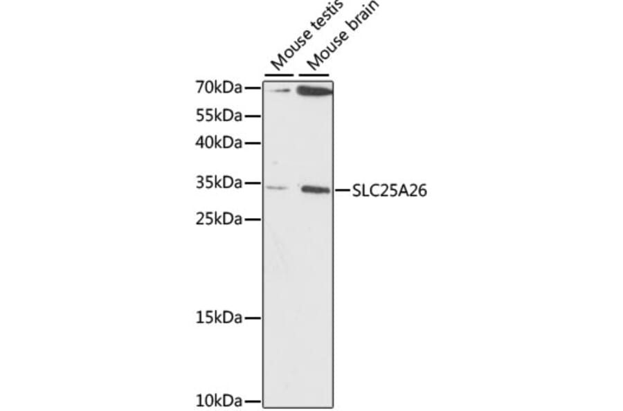 Western Blot - Anti-SLC25A26 Antibody (A89265) - Antibodies.com