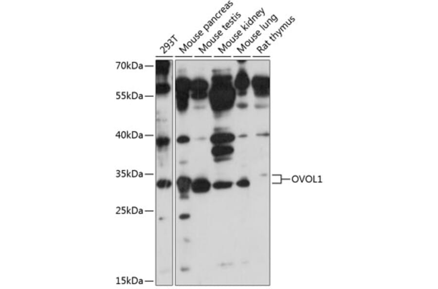 Western Blot - Anti-OVOL1 Antibody (A89266) - Antibodies.com
