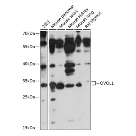 Western Blot - Anti-OVOL1 Antibody (A89266) - Antibodies.com