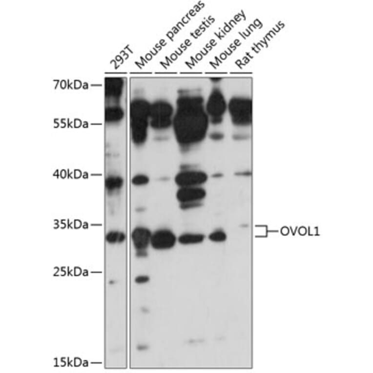 Western Blot - Anti-OVOL1 Antibody (A89266) - Antibodies.com