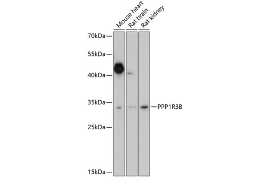 Western Blot - Anti-PPP1R3B Antibody (A89267) - Antibodies.com