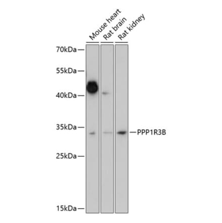 Western Blot - Anti-PPP1R3B Antibody (A89267) - Antibodies.com