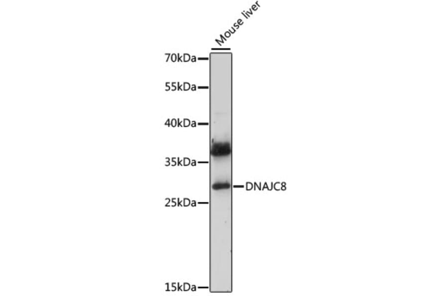 Western Blot - Anti-DjC8 Antibody (A89269) - Antibodies.com