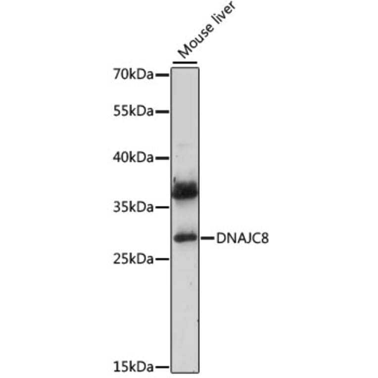 Western Blot - Anti-DjC8 Antibody (A89269) - Antibodies.com