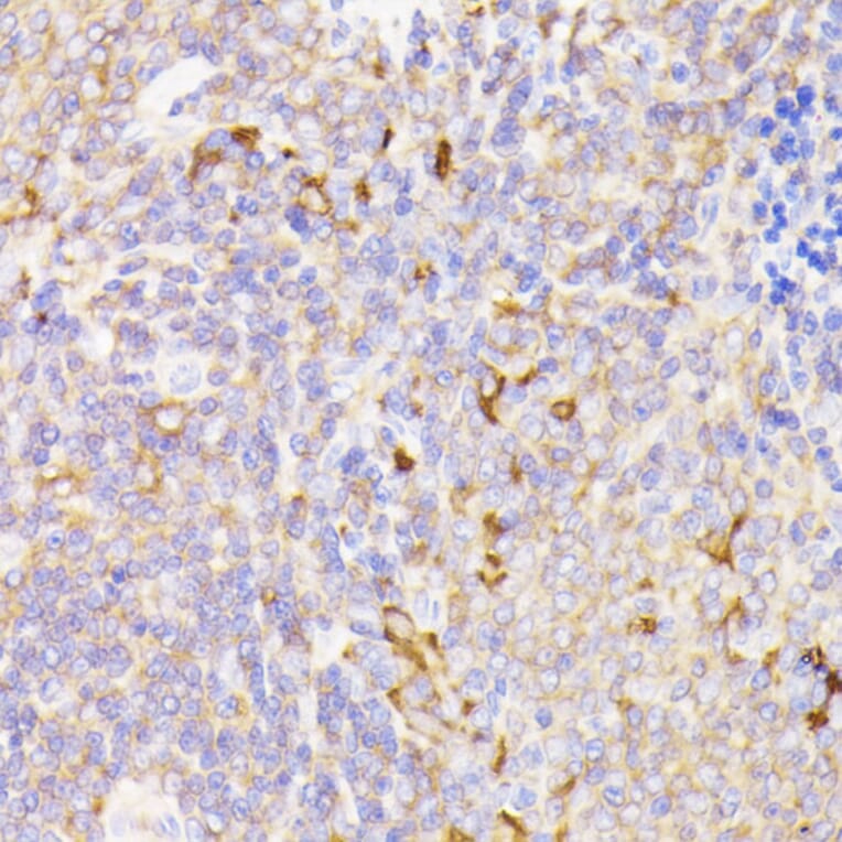 Immunohistochemistry - Anti-PSMG1 Antibody (A89271) - Antibodies.com