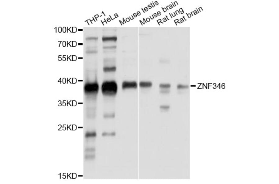 Western Blot - Anti-ZNF346 Antibody (A13406) - Antibodies.com