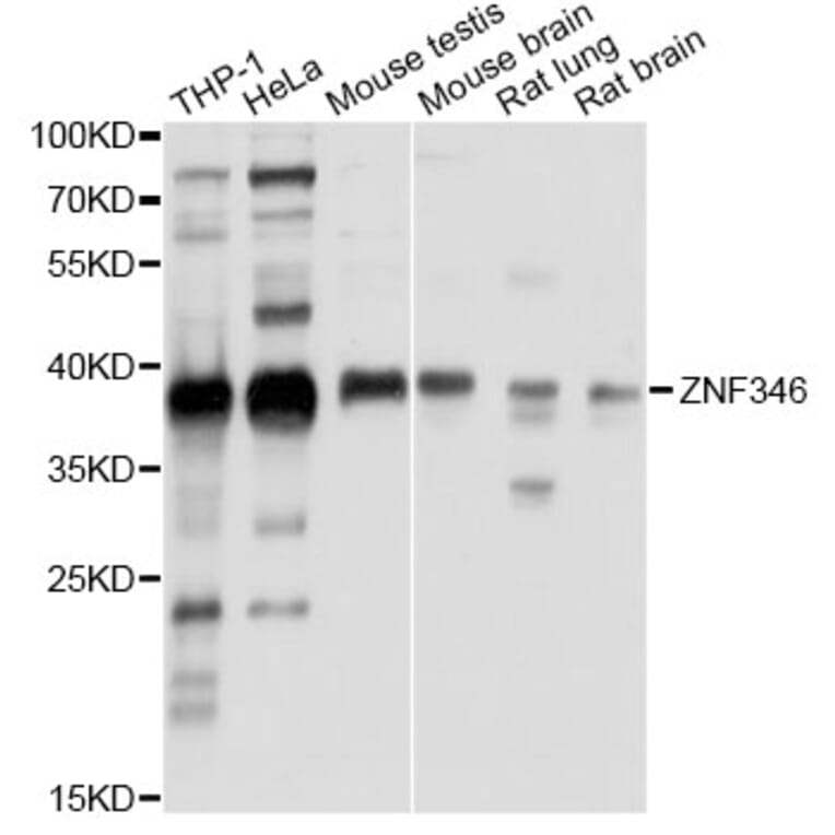 Western Blot - Anti-ZNF346 Antibody (A13406) - Antibodies.com