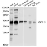 Western Blot - Anti-ZNF346 Antibody (A13406) - Antibodies.com