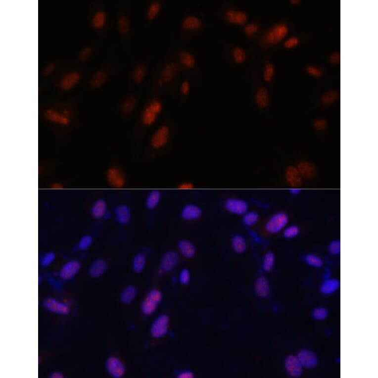 Immunofluorescence - Anti-ZNF346 Antibody (A13406) - Antibodies.com
