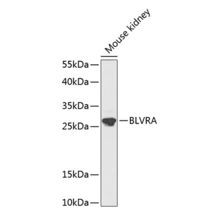Western Blot - Anti-BVR Antibody (A89273) - Antibodies.com