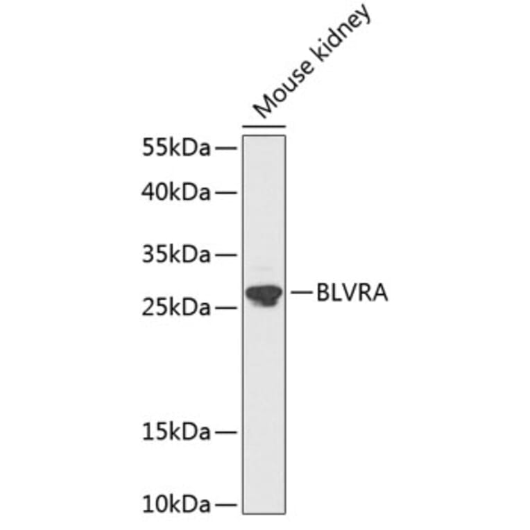 Western Blot - Anti-BVR Antibody (A89273) - Antibodies.com