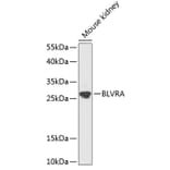 Western Blot - Anti-BVR Antibody (A89273) - Antibodies.com