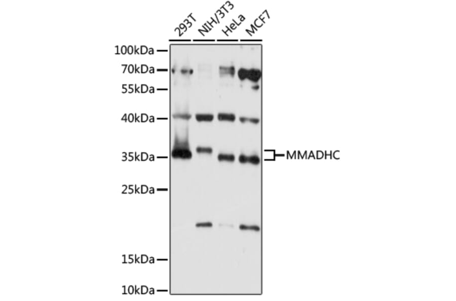 Western Blot - Anti-MMADHC Antibody (A89274) - Antibodies.com
