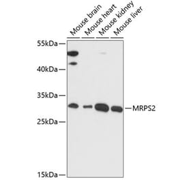 Western Blot - Anti-MRPS2 Antibody (A89275) - Antibodies.com