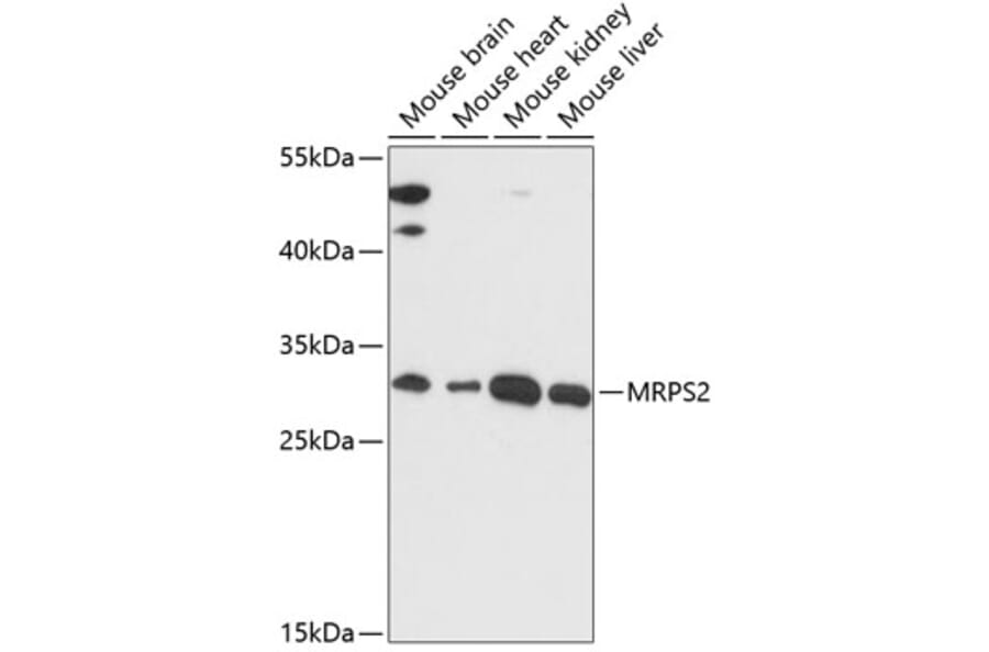 Western Blot - Anti-MRPS2 Antibody (A89275) - Antibodies.com