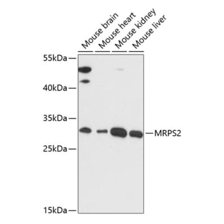 Western Blot - Anti-MRPS2 Antibody (A89275) - Antibodies.com