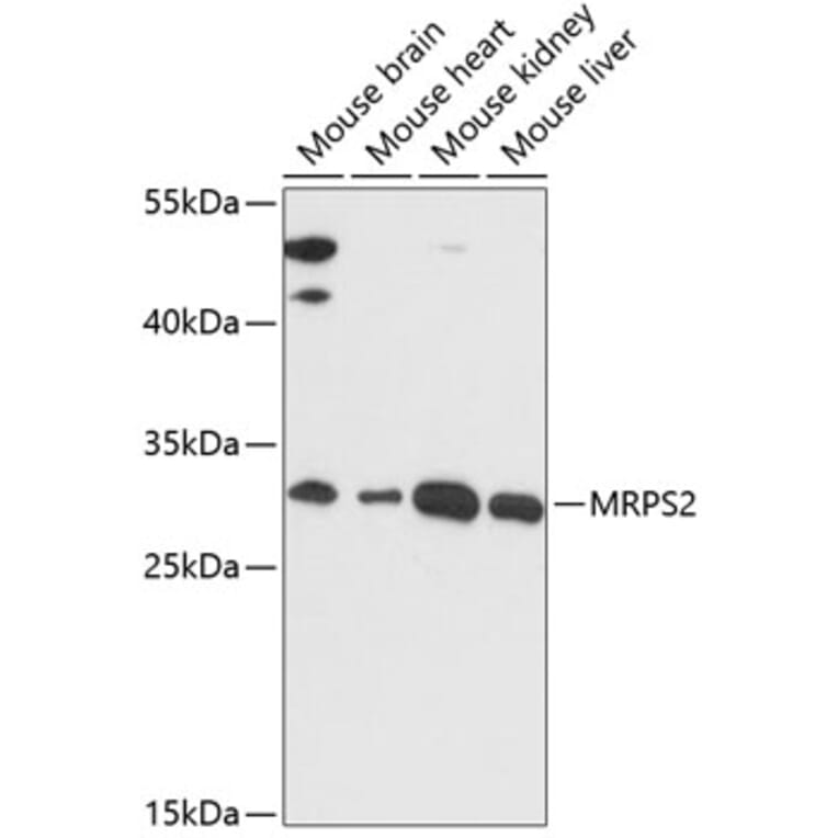 Western Blot - Anti-MRPS2 Antibody (A89275) - Antibodies.com