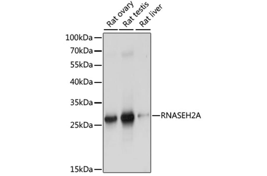 Western Blot - Anti-Ribonuclease H2, subunit A/RNASEH2A Antibody (A89276) - Antibodies.com