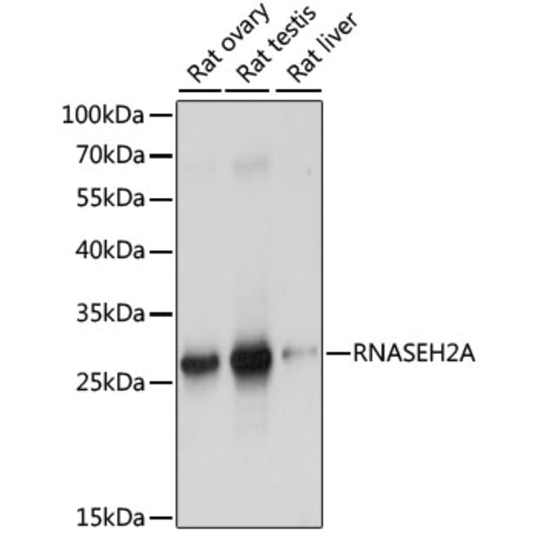 Western Blot - Anti-Ribonuclease H2, subunit A/RNASEH2A Antibody (A89276) - Antibodies.com