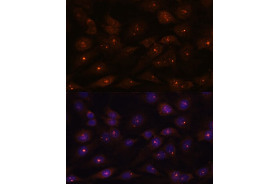 Immunofluorescence - Anti-Ribonuclease H2, subunit A/RNASEH2A Antibody (A89276) - Antibodies.com