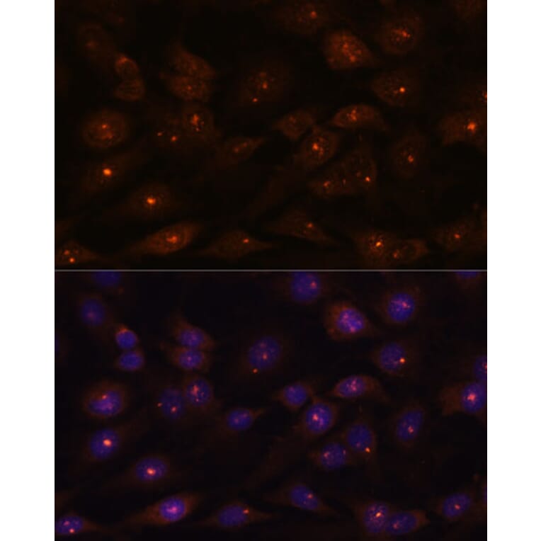 Immunofluorescence - Anti-Ribonuclease H2, subunit A/RNASEH2A Antibody (A89276) - Antibodies.com