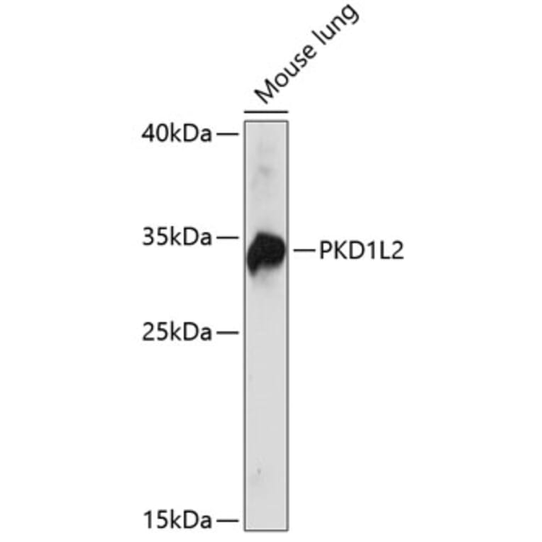 Western Blot - Anti-PKD1L2 Antibody (A89277) - Antibodies.com