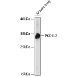 Western Blot - Anti-PKD1L2 Antibody (A89277) - Antibodies.com