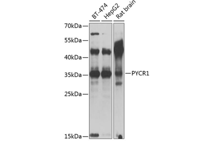 Western Blot - Anti-PYCR1 Antibody (A89278) - Antibodies.com