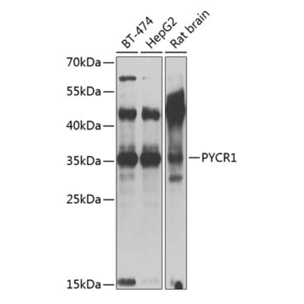 Western Blot - Anti-PYCR1 Antibody (A89278) - Antibodies.com
