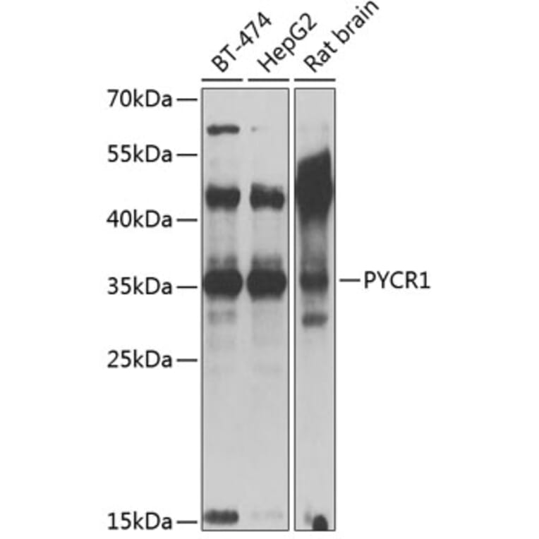 Western Blot - Anti-PYCR1 Antibody (A89278) - Antibodies.com