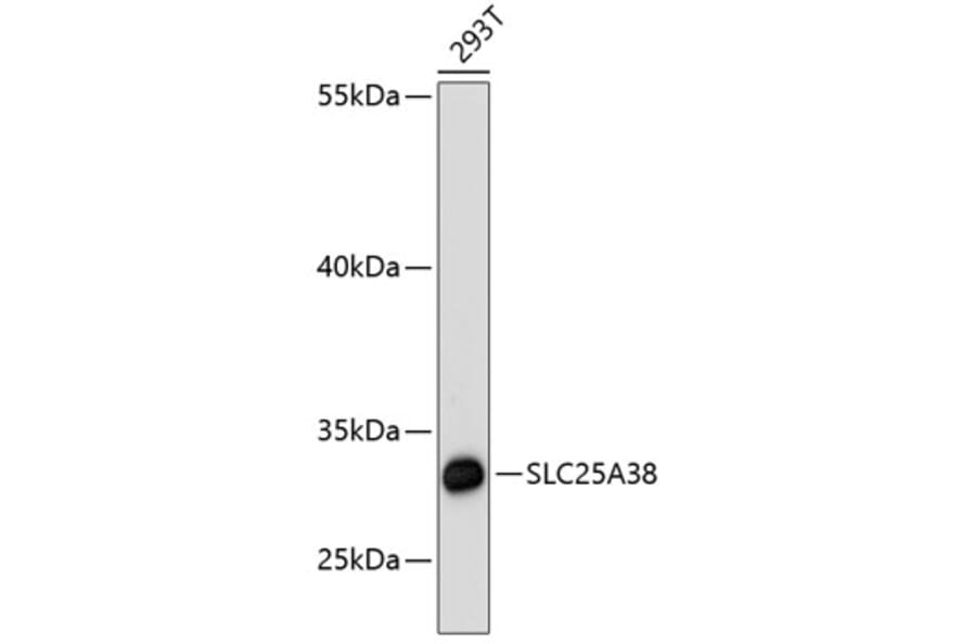 Western Blot - Anti-SLC25A38 Antibody (A89279) - Antibodies.com