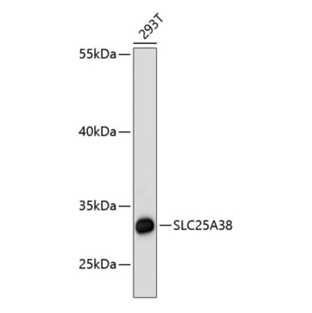 Western Blot - Anti-SLC25A38 Antibody (A89279) - Antibodies.com