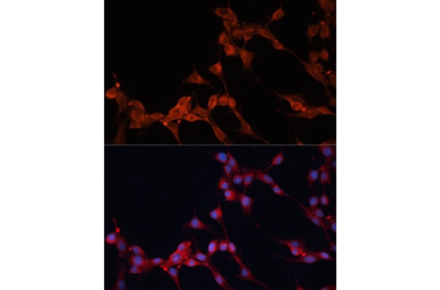 Immunofluorescence - Anti-SLC25A38 Antibody (A89279) - Antibodies.com