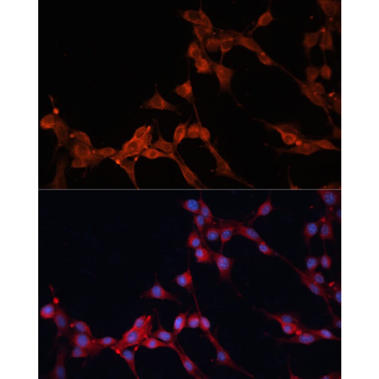 Immunofluorescence - Anti-SLC25A38 Antibody (A89279) - Antibodies.com