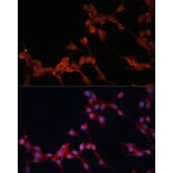 Immunofluorescence - Anti-SLC25A38 Antibody (A89279) - Antibodies.com