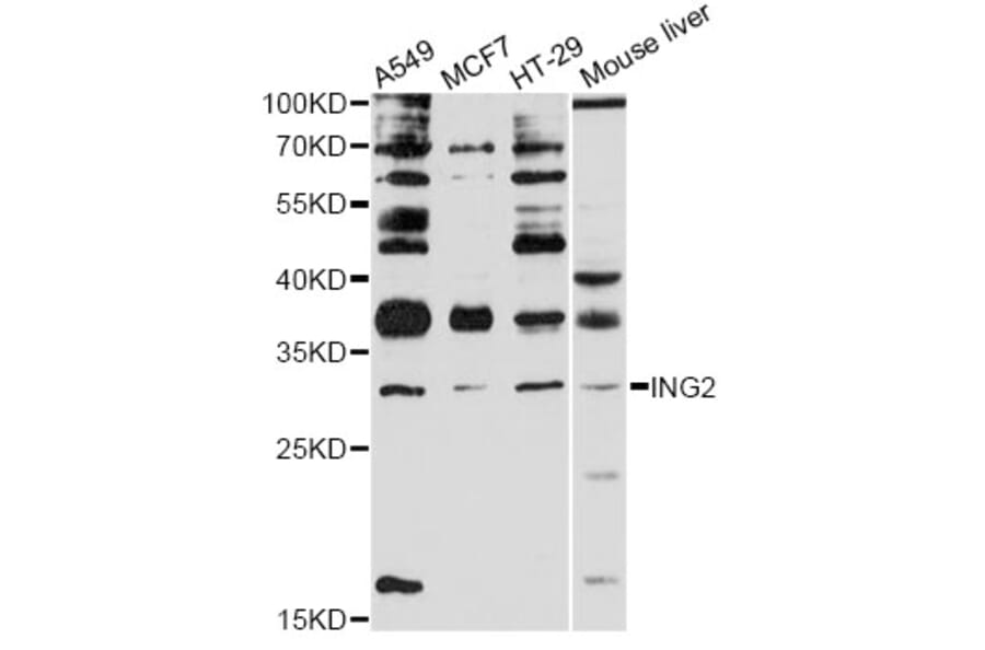 Western Blot - Anti-ING2 Antibody (A12266) - Antibodies.com