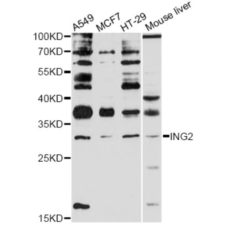 Western Blot - Anti-ING2 Antibody (A12266) - Antibodies.com